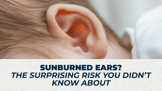 Sunburned Ears? The Surprising Risk You Didn’t Know About